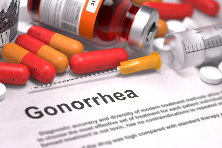 Can You Treat Gonorrhea Without a Clinic Visit Treat Gonorrhea